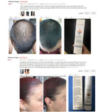 OMY LADY Hair Growth Spray Anti Hair Loss Essential Fast Regrowth Prevent Hair Damaged Thinning Repair Care Scalp Treatment 60ml